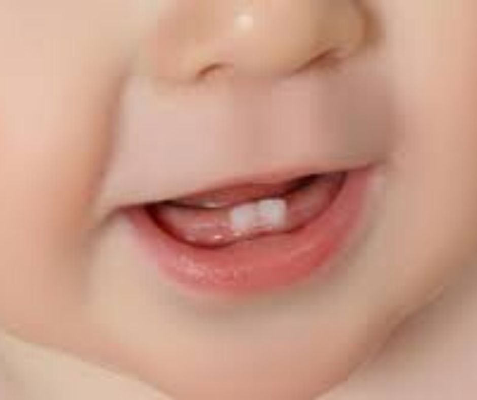 O meu filho já tem dentes – o que fazer?