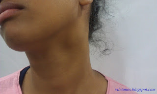 O meu filho tem uns “carocinhos” no pescoço – é normal?