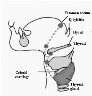 Um caroço no pescoço