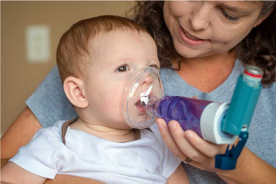 Camara expansora. Uma ajuda preciosa