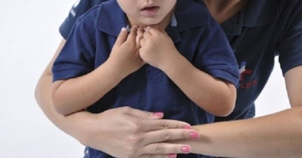 O que fazer quando uma criança se engasga?