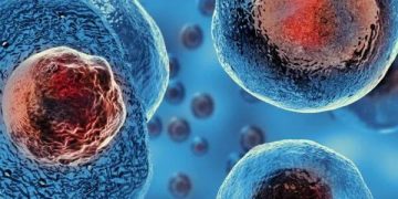 Sabia que já foram realizados mais de 45.000 transplantes com Células Estaminais do Sangue do Cordão Umbilical em adultos e crianças?