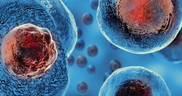 Sabia que já foram realizados mais de 45.000 transplantes com Células Estaminais do Sangue do Cordão Umbilical em adultos e crianças?