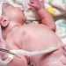 O Dia Mundial do Sangue do Cordão Umbilical, um dia que pretende alertar para a importância desta fonte de Células Estaminais
