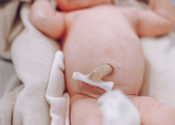 Reduzida probabilidade de transmissão de SARS-CoV-2 através de Sangue do cordão umbilical – Evidência científica e experiência da Crioestaminal