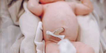 Reduzida probabilidade de transmissão de SARS-CoV-2 através de Sangue do cordão umbilical – Evidência científica e experiência da Crioestaminal