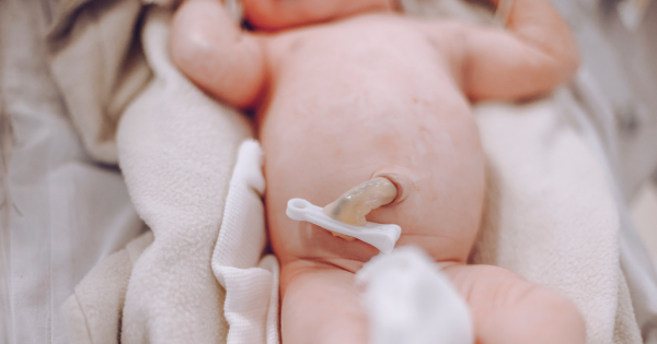 Reduzida probabilidade de transmissão de SARS-CoV-2 através de Sangue do cordão umbilical – Evidência científica e experiência da Crioestaminal