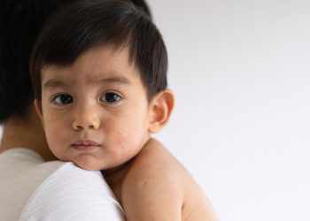 As 10 doenças mais comuns em Pediatria: Virose