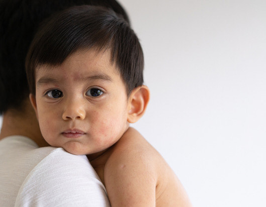 As 10 doenças mais comuns em Pediatria: Virose