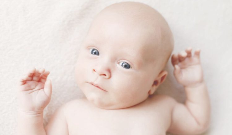 O que é o torcicolo congénito?